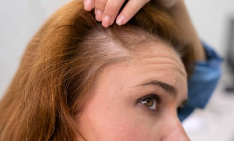 ¿Cuáles son los tratamientos capilares más eficaces para fortalecer el cabello y evitar su caída?